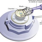 Trasplante corneal figura 8